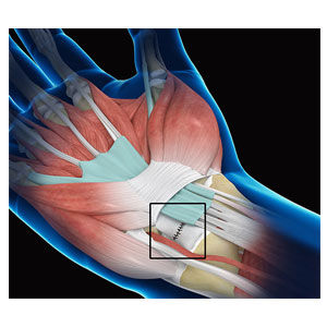 https://www.academyorthopedics.com/wp-content/uploads/2021/04/wrist-ligament-injury.jpg