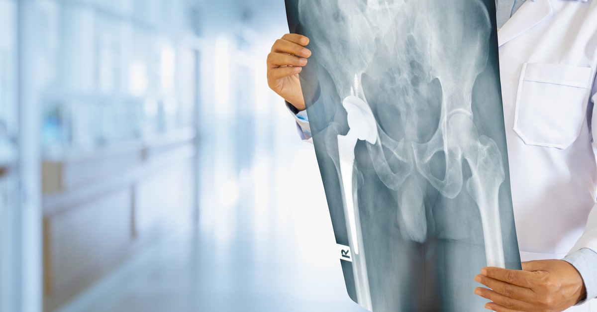 https://www.academyorthopedics.com/wp-content/uploads/2022/06/Academy-Orthopedics-are-the-very-best-at-minimally-invasive-total-hip-replacement-surgery.jpg