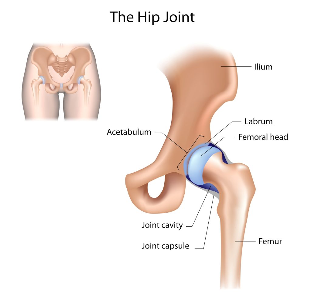 problematic hip joint